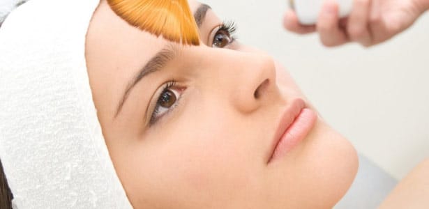 Peeling químico