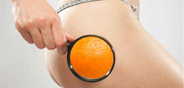 Como acabar com a celulite? Com tratamentos naturais!