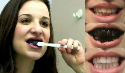 Blank Dent - Como clarear os dentes rápido (dentes brancos)