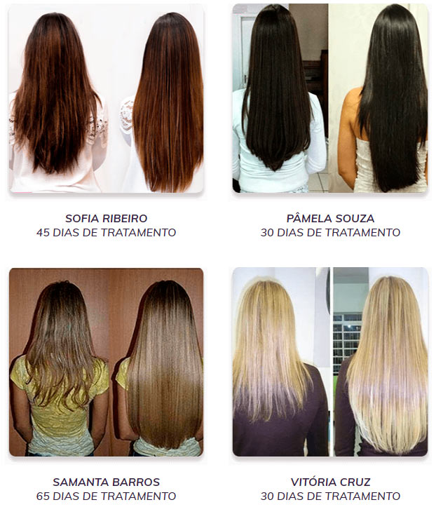 Resultado Capelli Hair: Antes e Depois