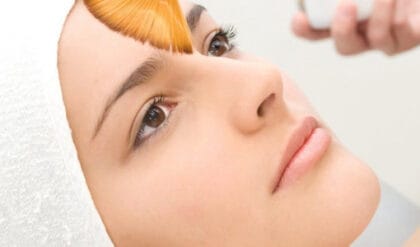 Peeling Químico